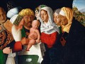 thumbnail Circumcision